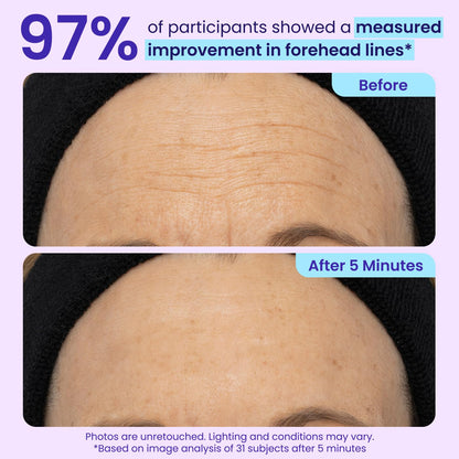 Eye cream targeting puffiness, under-eye bags, wrinkles, fine lines, and dark circles.