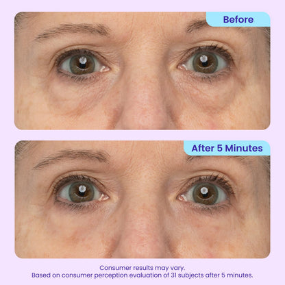 Eye cream targeting puffiness, under-eye bags, wrinkles, fine lines, and dark circles.